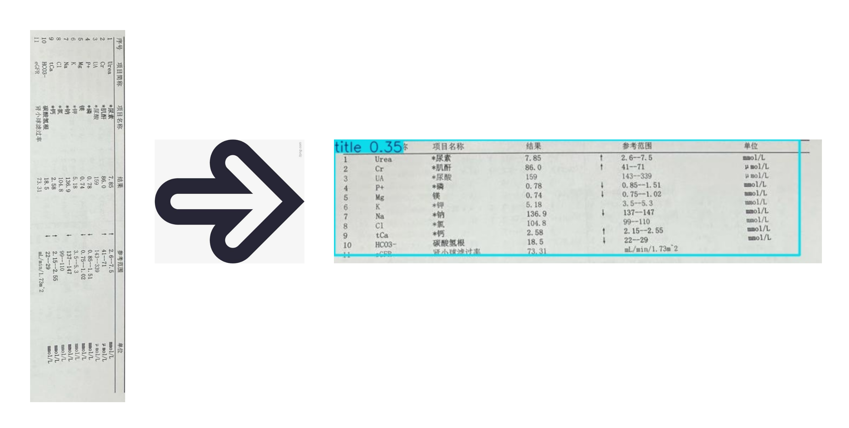 减少30%人工处理时间，AI OCR与表格识别助力医疗化验单快速处理